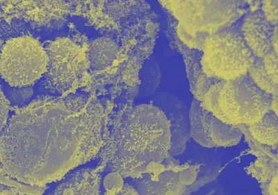 A scanning electron micrograph of a fetal gut, pseudocolored in yellow and blue